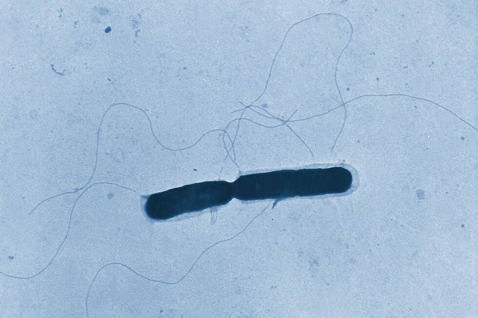 Esta imagen de microscopio proporcionada por los Centros para el Control y la Prevención de...