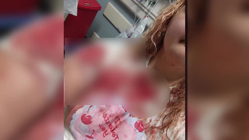 Mujer asegura haber sido brutalmente golpeada tras disputa por puesto de estacionamiento. Dijo...